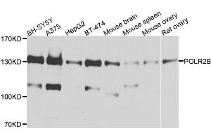 Western blot analysis of extracts of various cell lines, using POLR2B antibody. (POLR2B 抗体)