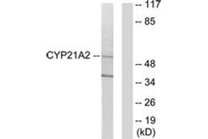 Western blot analysis of extracts from 293 cells, using Cytochrome P450 21A2 Antibody. (CYP21A2 抗体  (AA 151-200))