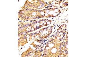 (ABIN6242230 and ABIN6577881) staining Epcam in Mouse colon tissue sections by Immunohistochemistry (IHC-P - paraformaldehyde-fixed, paraffin-embedded sections). (EpCAM 抗体  (C-Term))