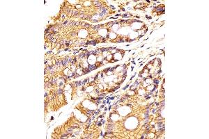 Immunohistochemistry (Paraffin-embedded Sections) (IHC (p)) image for anti-Epithelial Cell Adhesion Molecule (EPCAM) (AA 302-335), (C-Term) antibody (ABIN6242230)