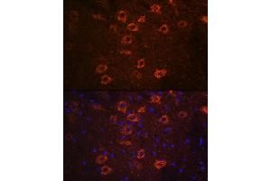Immunofluorescence (IF) image for anti-Solute Carrier Family 18 (Vesicular Acetylcholine), Member 3 (SLC18A3) (AA 1-150) antibody (ABIN7270410)