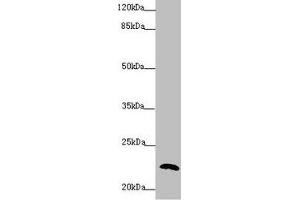 Western blot All lanes: PPIF antibody at 5. (PPIF 抗体  (AA 30-207))