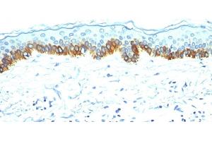 Formalin-fixed, paraffin-embedded human Skin stained with Cytokeratin, LMW Mouse Monoclonal Antibody (AE-1). (Keratin 77 抗体)