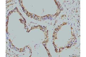 IHC analysis of RPA32/RPA2 using anti-RPA32/RPA2 antibody (ABIN7601379). (RPA2 抗体  (AA 34-254))