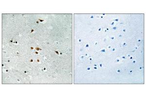 Immunohistochemistry analysis of paraffin-embedded human brain tissue using FER (Phospho-Tyr402) antibody. (FER 抗体  (pTyr402))