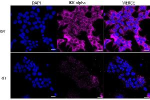 Immunocytochemical staining of HeLa cells using IKK alpha antibody (ABIN7798147), 1:1,000), Top panel: wild-type (WT), Bottom panal: IKK alpha shRNA knockdown (KD). (Recombinant IKK alpha 抗体)