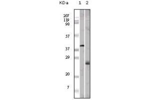 Western blot analysis using ApoM antibody against GST-ApoM recombinant protein (1) and human serum (2). (Apolipoprotein M 抗体)
