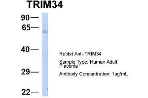 Host:  Rabbit  Target Name:  TRIM34  Sample Type:  Human Adult Placenta  Antibody Dilution:  1. (TRIM34 抗体  (N-Term))