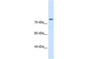 WB Suggested Anti-ACTN4 Antibody Titration:  0. (alpha Actinin 4 抗体  (C-Term))