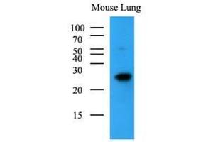 Mouse lung lysates (35 ug) were resolved by SDS-PAGE, transferred to nitrocellulose membrane and probed with anti-human BAK1 (1:500). (BAK1 抗体  (AA 29-187))