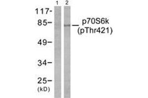 Western blot analysis of extracts from NIH-3T3 cells treated with EGF 200ng/ml 30', using p70 S6 Kinase (Phospho-Thr421) Antibody. (RPS6KB1 抗体  (pThr444))