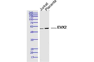 Lane 1: jurkat lysates Lane 2: mouse placenta lysates probed with EVX2 Polyclonal Antibody, Unconjugated  at 1:300 dilution and 4˚C overnight incubation. (EVX2 抗体  (AA 1-100))