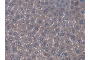 Detection of ZRF1 in Mouse Liver Tissue using Polyclonal Antibody to Zuotin Related Factor 1 (ZRF1) (DNAJC2 抗体  (AA 368-621))