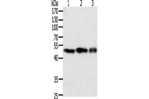 Western Blotting (WB) image for anti-Coagulation Factor VII (F7) antibody (ABIN2428811) (Factor VII 抗体)
