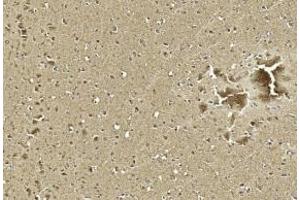 Immunohistochemical analysis of paraffin-embedded Human brain section using Pink1 D. (S100B 抗体)