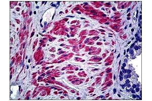 Human Prostate: Formalin-Fixed, Paraffin-Embedded (FFPE) (COL5A2 抗体  (C-Term, Chain alpha 2))