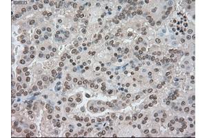 Image no. 2 for anti-Budding Uninhibited By Benzimidazoles 1 Homolog beta (Yeast) (BUB1B) antibody (ABIN1497000) (BUB1B 抗体)