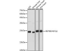 Western blot analysis of extracts of various cell lines, using HSPB8/HSP22 antibody (ABIN3016166, ABIN3016167, ABIN3016168 and ABIN6219596) at 1:3000 dilution. (HSPB8 抗体  (AA 1-196))