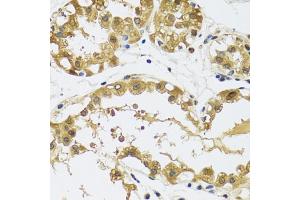 Immunohistochemistry of paraffin-embedded human breast using RPS12 antibody (ABIN5973491) at dilution of 1/100 (40x lens). (RPS12 抗体)