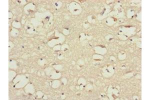 Immunohistochemistry of paraffin-embedded human brain tissue using ABIN7145604 at dilution of 1:100 (BLOC1S2 抗体  (AA 44-142))