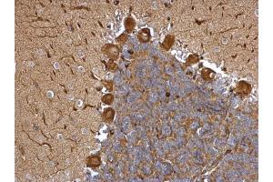 Immunohistochemistry (IHC) image for anti-Echinoderm Microtubule Associated Protein Like 1 (EML1) (C-Term) antibody (ABIN2854673)