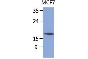 The lysate of MCF7 (40ug) were resolved by SDS-PAGE, transferred to PVDF membrane and probed with anti-human SSR4 antibody (1:1000). (SSR4 抗体)