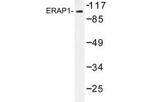 Image no. 2 for anti-Endoplasmic Reticulum Aminopeptidase 1 (ERAP1) antibody (ABIN272255) (ERAP1 抗体)
