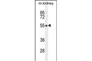 FBXO47 Antibody (N-term) (ABIN655283 and ABIN2844874) western blot analysis in mouse kidney tissue lysates (35 μg/lane). (FBXO47 抗体  (N-Term))