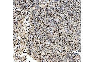 IHC analysis of SFPQ using anti-SFPQ antibody (ABIN7603089). (SFPQ 抗体  (Middle Region))