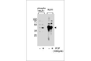 Western blot analysis of extracts from A431 cell,untreated or treated with EGF,100 ng/mL,using Phospho-MEK1-p(left) or MEK1-p Antibody (right). (MEK1 抗体  (pSer222))