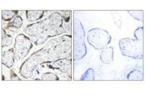 Immunohistochemistry analysis of paraffin-embedded human placenta tissue using EFEMP2 antibody. (FBLN4 抗体)