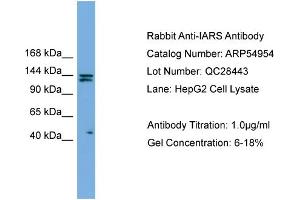 WB Suggested Anti-IARS  Antibody Titration: 0. (IARS 抗体  (Middle Region))