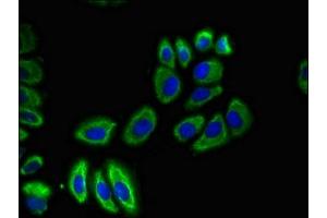 Immunofluorescent analysis of A549 cells using ABIN7170088 at dilution of 1:100 and Alexa Fluor 488-congugated AffiniPure Goat Anti-Rabbit IgG(H+L) (SLC12A7 抗体  (AA 11-117))