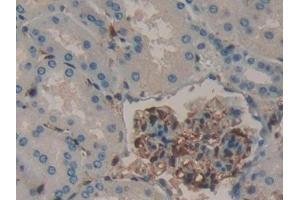Detection of GAL1 in Human Kidney Tissue using Polyclonal Antibody to Galectin 1 (GAL1) (LGALS1/Galectin 1 抗体  (AA 1-135))