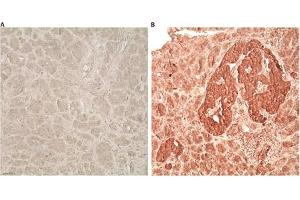 Immunohistochemistry analysis of human pancreas tissue using Glucagon like peptide 1 pAb,  at a dilution of 1:1000. (GLP-1 抗体  (AA 1-19))