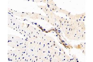 Immunohistochemistry analysis of paraffin-embedded rat heart using DLL4 Polyclonal Antibody at dilution of 1:200. (DLL4 抗体)