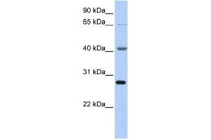 WB Suggested Anti-RBM34 Antibody Titration:  0. (RBM34 抗体  (C-Term))