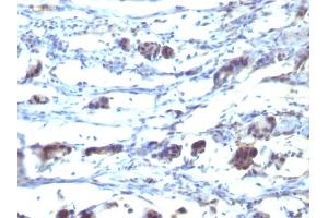 Formalin-fixed, paraffin-embedded human Stomach tissue stained with CD195 Mouse Monoclonal Antibody (12D1). (CCR5 抗体)