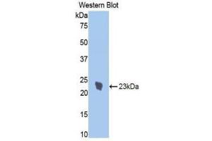 Western Blotting (WB) image for anti-Interleukin 1 Receptor, Type I (IL1R1) (AA 386-553) antibody (ABIN3209483) (IL1R1 抗体  (AA 386-553))