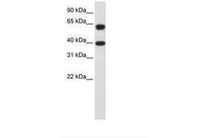 Image no. 3 for anti-Nuclear RNA Export Factor 3 (NXF3) (AA 435-484) antibody (ABIN203198) (NXF3 抗体  (AA 435-484))