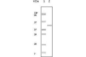 Western blot analysis using ABL2 mouse mAb against truncated ABL2 recombinant protein. (ABL2 抗体)