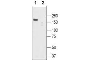 Western blot analysis of mouse brain lysate: - 1. (TRPC2 抗体  (Intracellular, N-Term))