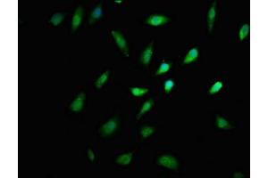 Immunofluorescence staining of SH-SY5Y cells with ABIN7158375 at 1:167, counter-stained with DAPI. (LIMD2 抗体  (AA 1-127))