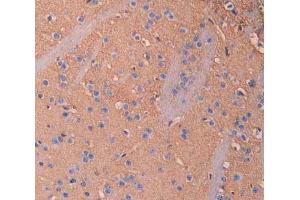 Used in DAB staining on fromalin fixed paraffin- embedded brain tissue (IL18BP 抗体  (AA 29-193))