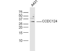 Human A431 cells probed with CCDC124 Polyclonal Antibody, unconjugated  at 1:300 overnight at 4°C followed by a conjugated secondary antibody at 1:10000 for 90 minutes at 37°C. (CCDC124 抗体  (AA 145-223))