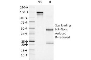 SDS-PAGE Analysis Purified BCL-6 Mouse Monoclonal Antibody (BCL6/1527). (BCL6 抗体  (AA 256-389))
