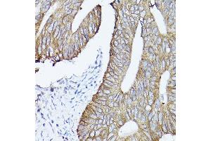 Immunohistochemistry (IHC) image for anti-Keratin 19 (KRT19) (AA 241-400) antibody (ABIN3020779)