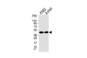 Western blot analysis of extracts from, K562 cells (Lane 1) and Jurket cells (Lane 2), using Mnk1 (Ab-385) Antibody. (MKNK1 抗体)