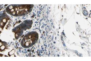 ABIN6267449 at 1/100 staining Mouse intestine tissue by IHC-P. (CXCR2 抗体  (pSer347))