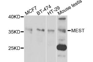 Western blot analysis of extracts of various cell lines, using MEST antibody. (MEST 抗体)